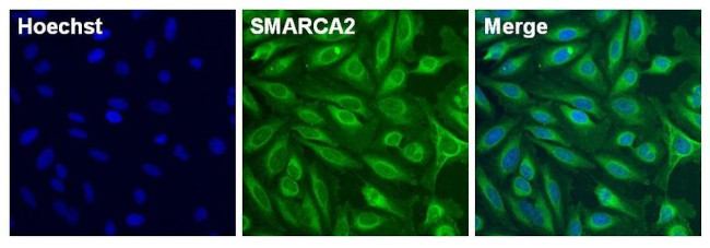 SMARCA2 Antibody in Immunocytochemistry (ICC/IF)