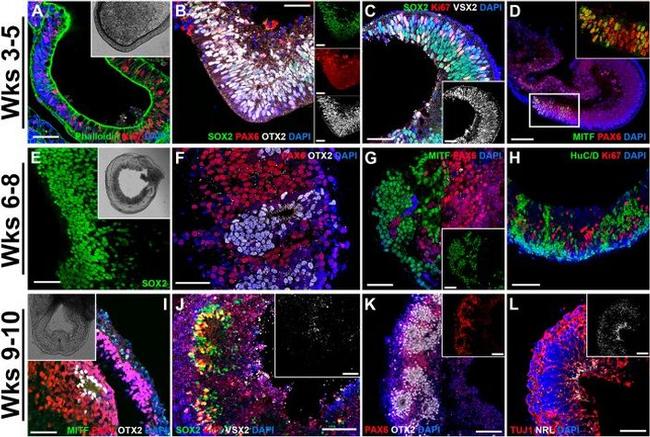 HuC/HuD Antibody in Immunocytochemistry (ICC/IF)