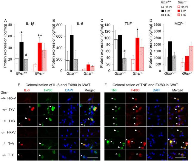 Immunohistochemistry staining images of (a) IL-6 and (c) TNF-α on