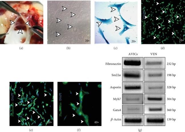 Alpha Smooth Muscle Actin Antibody Efluor 660 50 9760