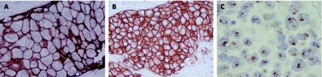 ErbB2 (HER-2) Antibody in Immunohistochemistry (IHC)