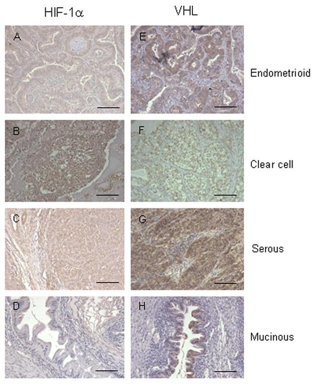 VHL Antibody in Immunohistochemistry (Paraffin) (IHC (P))