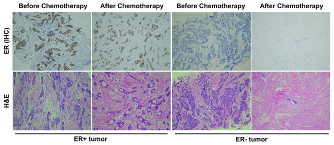 Estrogen Receptor alpha Antibody in Immunohistochemistry (IHC)