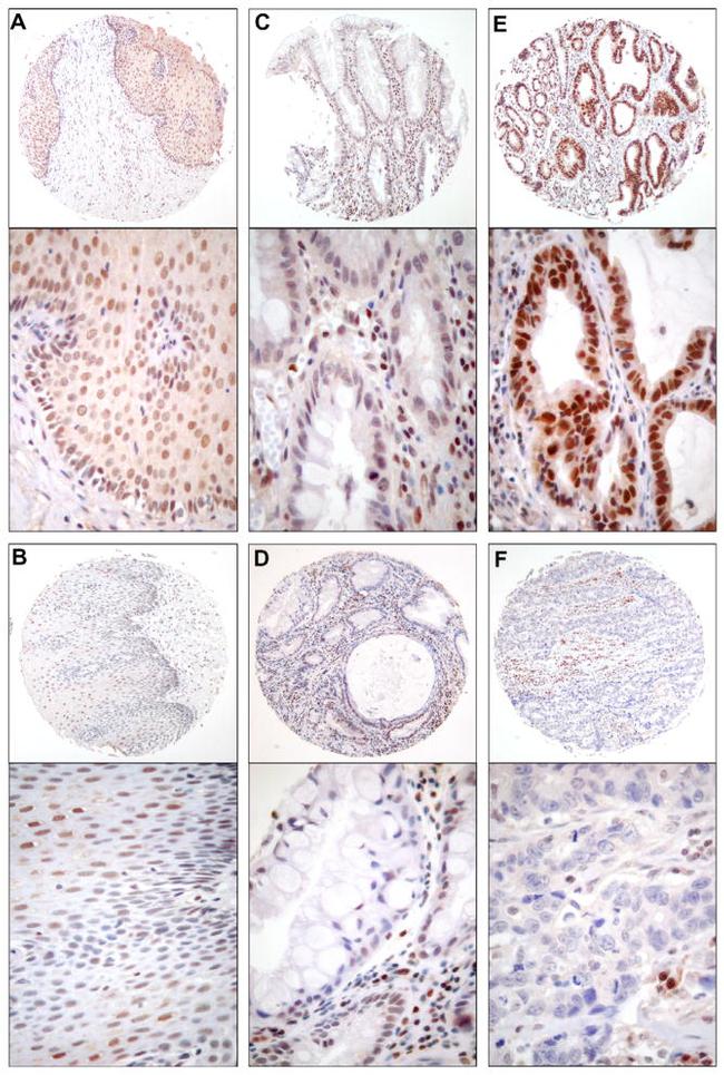 MGMT Antibody in Immunohistochemistry (IHC)