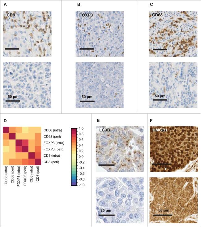 HMGB1 Antibody in Immunohistochemistry (IHC)