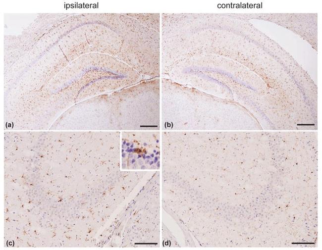 GFAP Antibody in Immunohistochemistry (IHC)