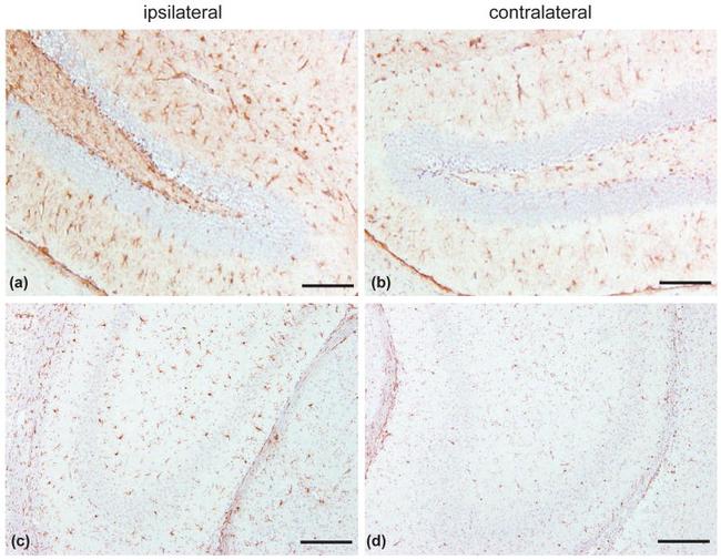 GFAP Antibody in Immunohistochemistry (IHC)