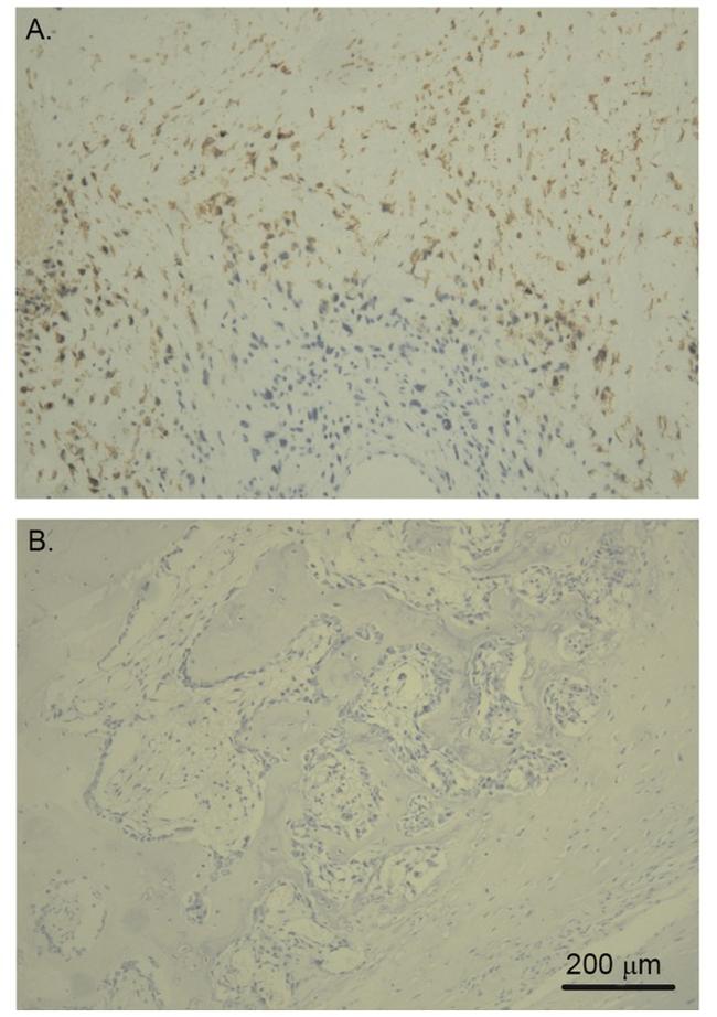 GLUT1 Antibody in Immunohistochemistry (IHC)