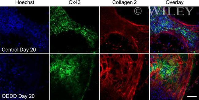 Collagen II Antibody in Immunocytochemistry (ICC/IF)