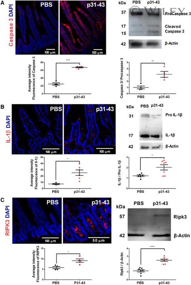 IL-1 beta Antibody in Western Blot, Immunocytochemistry (WB, ICC/IF)