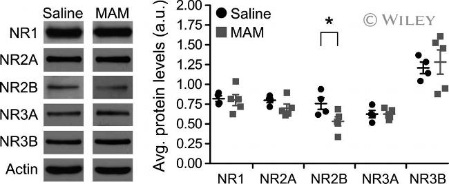 NMDAR1 Antibody in Western Blot (WB)