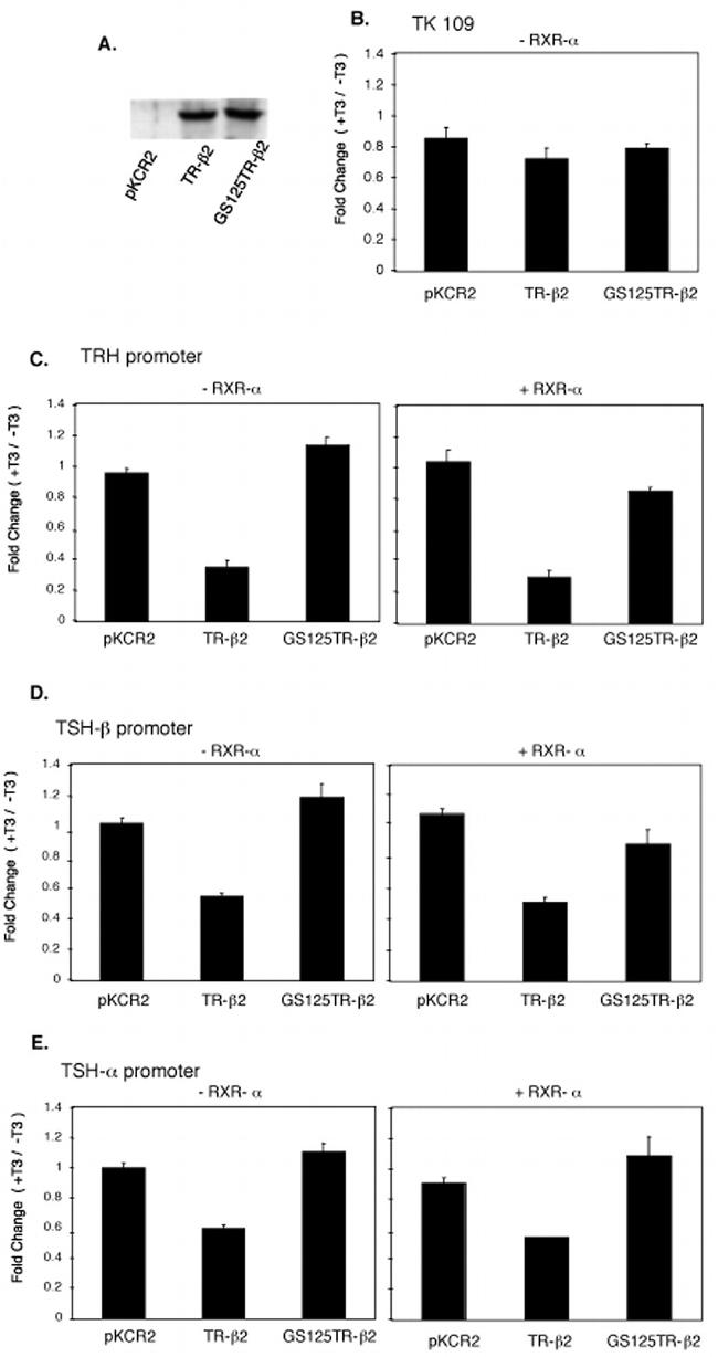 THRA/THRB Antibody in Western Blot (WB)