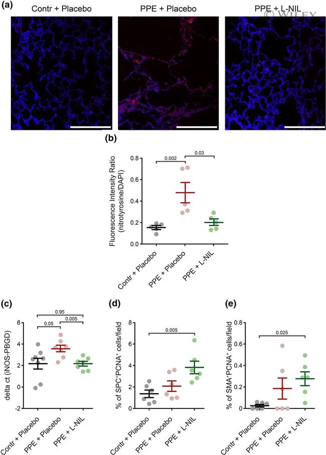 PCNA Antibody in Immunohistochemistry (IHC)