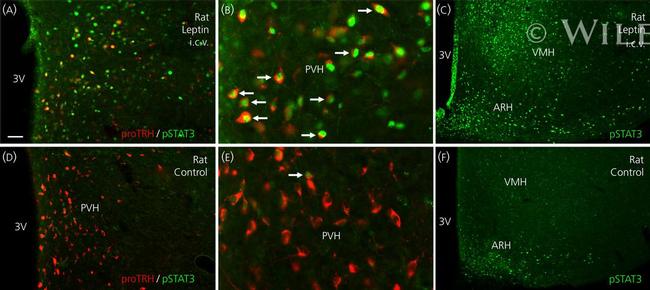 TRH Antibody in Immunohistochemistry (IHC)