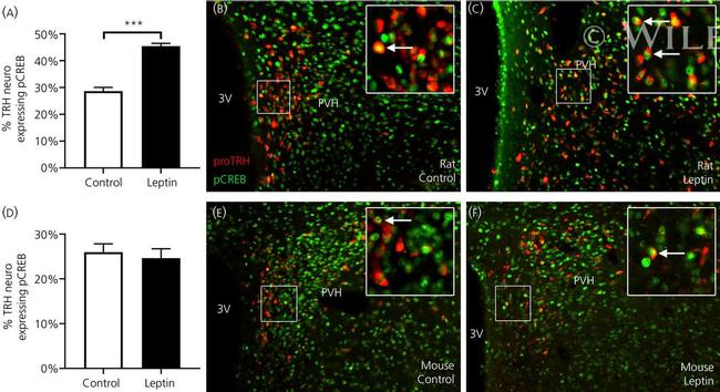 TRH Antibody in Immunohistochemistry (IHC)