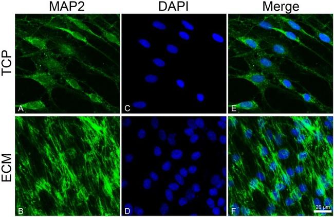 MAP2 Antibody in Immunocytochemistry (ICC/IF)