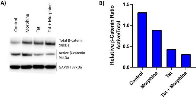 beta Catenin Antibody in Western Blot (WB)