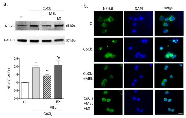 NFkB p65 Antibody in Western Blot, Immunocytochemistry (WB, ICC/IF)