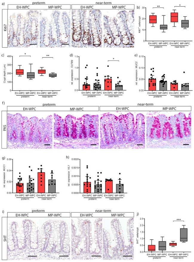 Serotonin Antibody in Immunohistochemistry (IHC)