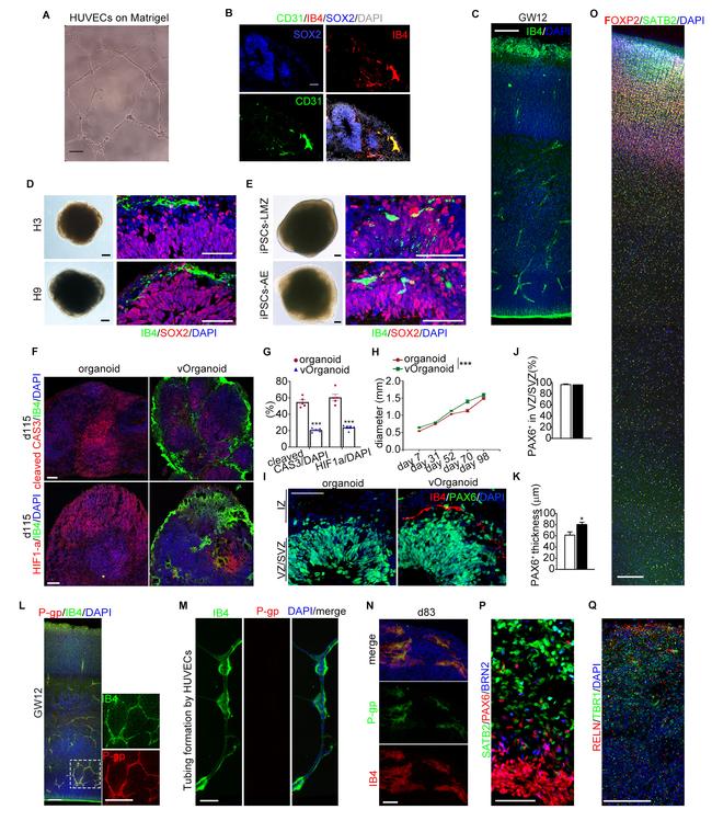 P-Glycoprotein Antibody in Immunocytochemistry (ICC/IF)