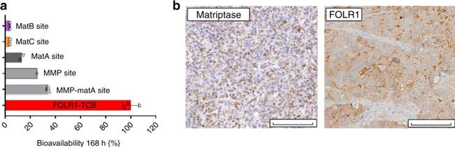 ST14 Antibody in Immunohistochemistry (IHC)