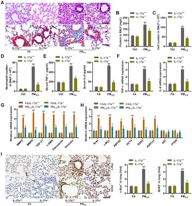 IL-17A Antibody in Immunohistochemistry (IHC)