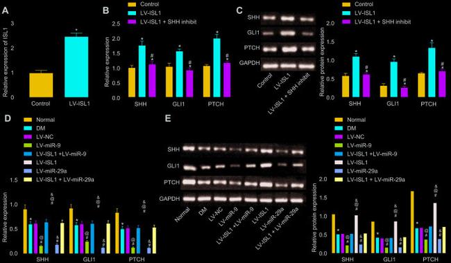 PTCH Antibody in Western Blot (WB)