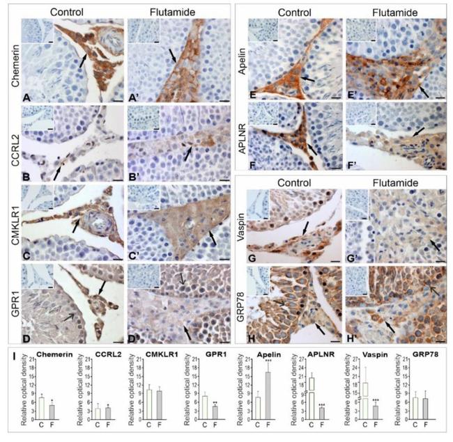 GRP78 Antibody in Immunohistochemistry (IHC)