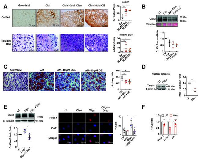 Collagen II Antibody in Immunohistochemistry (IHC)