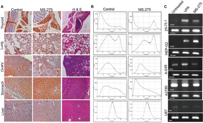 SLC5A5 Antibody in Immunohistochemistry (IHC)