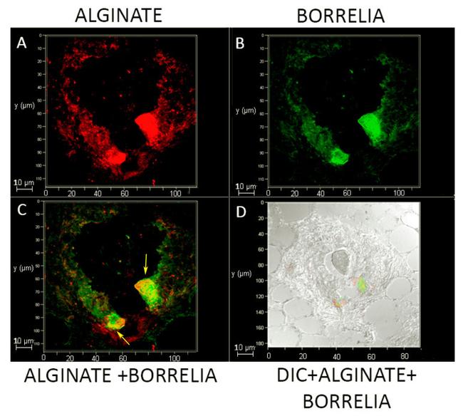 Borrelia burgdorferi Antibody in Immunohistochemistry (IHC)