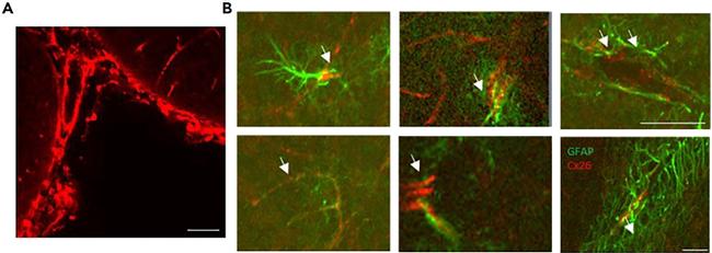 Connexin 26 Antibody in Immunohistochemistry (IHC)