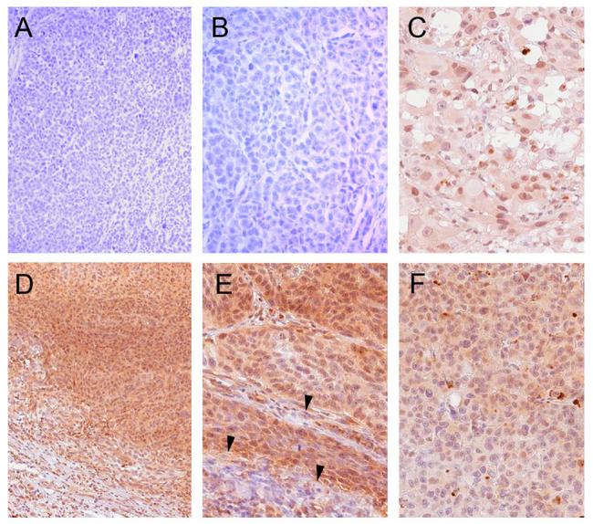 Bcl-B Antibody in Immunohistochemistry (IHC)