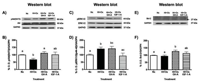 Phospho-AKT1 (Ser473) Antibody in Western Blot (WB)