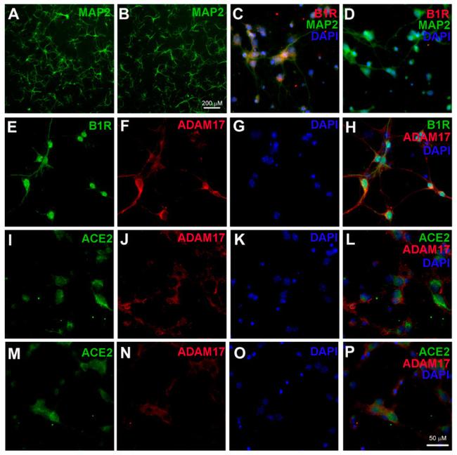 MAP2 Antibody in Immunocytochemistry (ICC/IF)