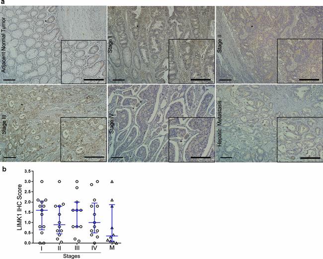 LIMK1 Antibody in Immunohistochemistry (IHC)