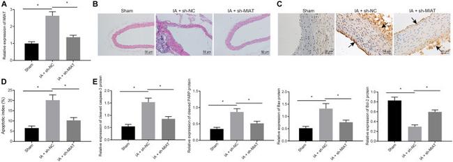 PARP1 (cleaved Asp214, Asp215) Antibody in Western Blot (WB)