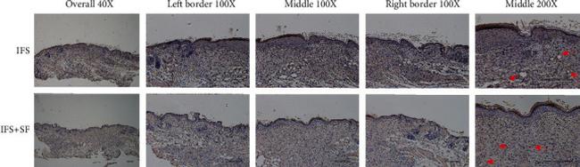 VEGF Antibody in Immunohistochemistry (IHC)