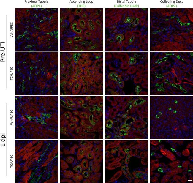 Uromodulin Antibody in Immunohistochemistry (IHC)