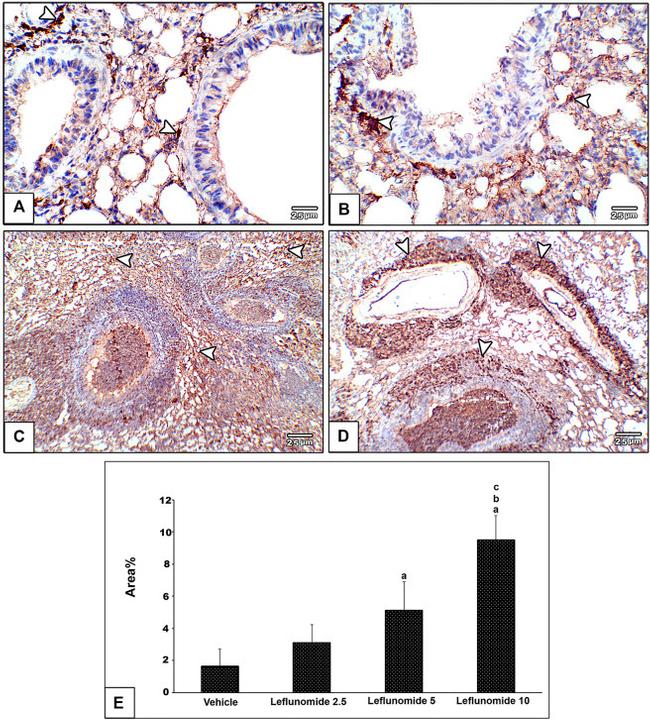 Vimentin Antibody in Immunohistochemistry (IHC)