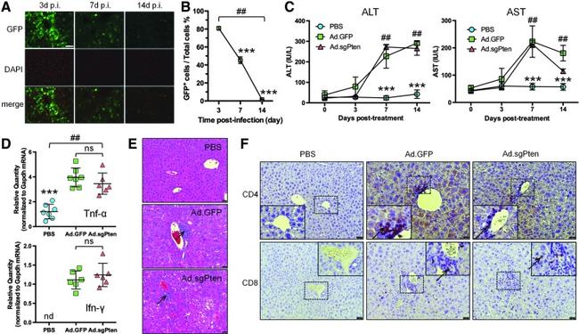 CD4 Antibody in Immunohistochemistry, Immunohistochemistry (Paraffin) (IHC, IHC (P))