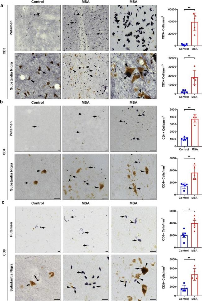 CD4 Antibody in Immunohistochemistry (IHC)