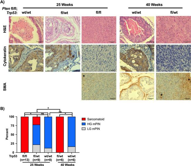 Cytokeratin Pan Antibody in Immunohistochemistry (IHC)