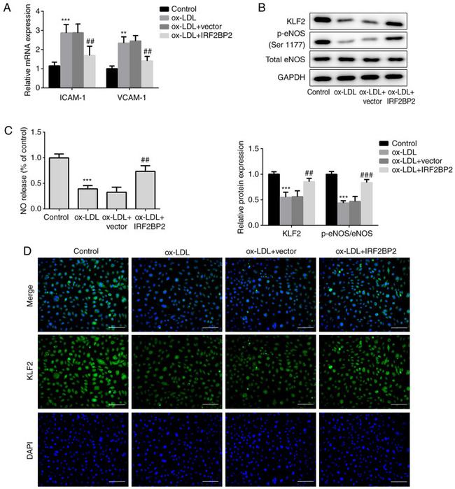 eNOS Antibody in Western Blot (WB)