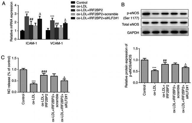 eNOS Antibody in Western Blot (WB)