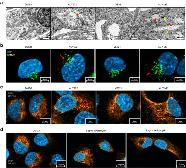 GRP94 Antibody in Immunocytochemistry (ICC/IF)