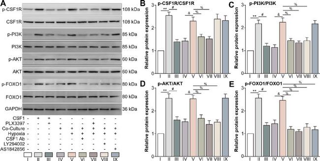 PI3K p85 alpha Antibody in Western Blot (WB)