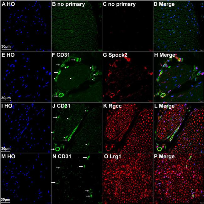 LRG1 Antibody in Immunohistochemistry (PFA fixed) (IHC (PFA))