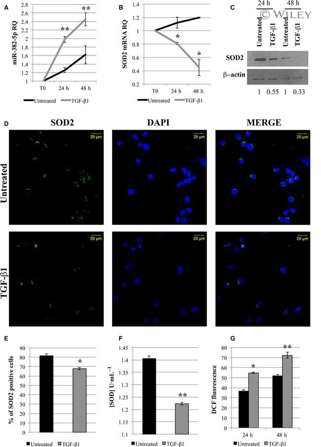 beta Actin Antibody in Western Blot (WB)