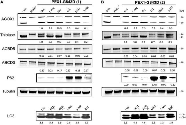 PMP70 Antibody in Western Blot (WB)